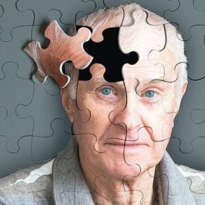 EXAMEN PREVENTIVO DE ALZHEIMER