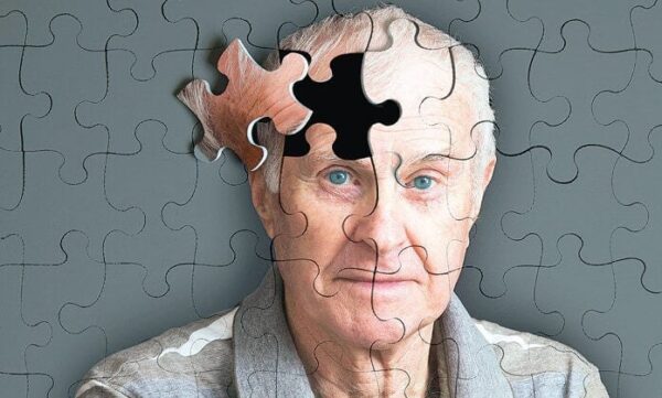 EXAMEN PREVENTIVO DE ALZHEIMER